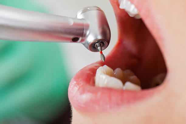 Best Emergency Cosmetic Dentistry in North Judson, IN